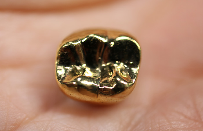 ゴールドクラウン